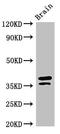 Microtubule Associated Protein RP/EB Family Member 2 antibody, LS-C678570, Lifespan Biosciences, Western Blot image 