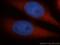 Dynein Cytoplasmic 1 Heavy Chain 1 antibody, 12345-1-AP, Proteintech Group, Immunofluorescence image 