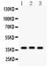 Cellular Communication Network Factor 2 antibody, PB9541, Boster Biological Technology, Western Blot image 