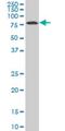 Hematopoietic Cell-Specific Lyn Substrate 1 antibody, H00003059-M04, Novus Biologicals, Western Blot image 