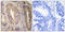 Protein Tyrosine Kinase 2 antibody, LS-C118286, Lifespan Biosciences, Immunohistochemistry frozen image 