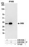 Spermidine Synthase antibody, A305-504A, Bethyl Labs, Immunoprecipitation image 