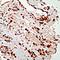 Platelet Derived Growth Factor Receptor Alpha antibody, PA5-32545, Invitrogen Antibodies, Immunohistochemistry paraffin image 