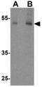 Angiopoietin-related protein 3 antibody, GTX17219, GeneTex, Western Blot image 