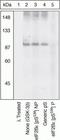 Eukaryotic Translation Initiation Factor 2B Subunit Epsilon antibody, GTX24775, GeneTex, Western Blot image 