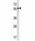 Bone Morphogenetic Protein 3 antibody, F45244-0.4ML, NSJ Bioreagents, Western Blot image 