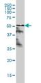 Retinoic Acid Receptor Alpha antibody, H00005914-M02, Novus Biologicals, Western Blot image 