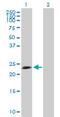 TPD52 Like 1 antibody, H00007164-B02P, Novus Biologicals, Western Blot image 
