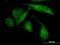 Rho Associated Coiled-Coil Containing Protein Kinase 2 antibody, orb89749, Biorbyt, Immunofluorescence image 