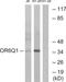 Olfactory Receptor Family 6 Subfamily Q Member 1 (Gene/Pseudogene) antibody, TA316240, Origene, Western Blot image 