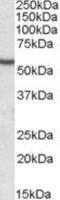 Desmin antibody, NBP1-45143, Novus Biologicals, Western Blot image 