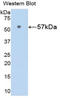 Nicotinamide Phosphoribosyltransferase antibody, LS-C305602, Lifespan Biosciences, Western Blot image 