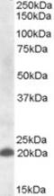 C-Type Lectin Domain Family 4 Member C antibody, LS-C108101, Lifespan Biosciences, Western Blot image 