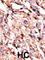 Branched Chain Keto Acid Dehydrogenase Kinase antibody, abx033187, Abbexa, Western Blot image 