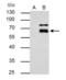 Matrix Metallopeptidase 8 antibody, GTX105428, GeneTex, Immunoprecipitation image 