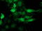 Cyclin Dependent Kinase 2 antibody, LS-C786032, Lifespan Biosciences, Immunofluorescence image 