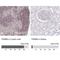 Proteasome subunit beta type-9 antibody, NBP2-33681, Novus Biologicals, Immunohistochemistry paraffin image 