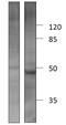 Cellular Communication Network Factor 2 antibody, GTX47807, GeneTex, Western Blot image 