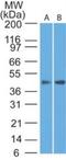 Somatostatin Receptor 1 antibody, NBP2-27413, Novus Biologicals, Western Blot image 