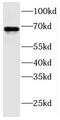 Ferredoxin-Fold Anticodon Binding Domain Containing 1 antibody, FNab03067, FineTest, Western Blot image 