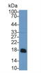 Acid Phosphatase antibody, LS-C297485, Lifespan Biosciences, Western Blot image 