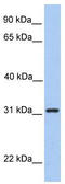 SRP Receptor Subunit Beta antibody, TA338465, Origene, Western Blot image 