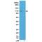 Glutamate Ionotropic Receptor AMPA Type Subunit 1 antibody, P02677-2, Boster Biological Technology, Western Blot image 