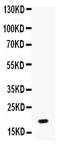 Pro-Platelet Basic Protein antibody, PB9878, Boster Biological Technology, Western Blot image 