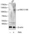 Mitogen-Activated Protein Kinase 6 antibody, A03011S189, Boster Biological Technology, Western Blot image 