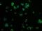 Thiopurine S-Methyltransferase antibody, MA5-25057, Invitrogen Antibodies, Immunocytochemistry image 