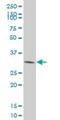 Cyclin Dependent Kinase 4 antibody, H00001019-M09, Novus Biologicals, Western Blot image 