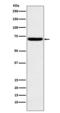 Heparanase antibody, M01313, Boster Biological Technology, Western Blot image 
