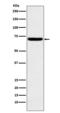 Hpa1 antibody, M01313, Boster Biological Technology, Western Blot image 