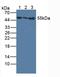 Interferon Alpha And Beta Receptor Subunit 1 antibody, LS-C299803, Lifespan Biosciences, Western Blot image 