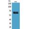 NUMB Endocytic Adaptor Protein antibody, LS-C387087, Lifespan Biosciences, Western Blot image 