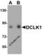 Serine/threonine-protein kinase DCLK1 antibody, 5633, ProSci Inc, Western Blot image 