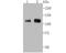 BAF Chromatin Remodeling Complex Subunit BCL11A antibody, A00741, Boster Biological Technology, Western Blot image 