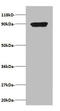 C-X-C Motif Chemokine Ligand 5 antibody, A51689-100, Epigentek, Western Blot image 