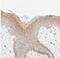 Keratin 15 antibody, NBP1-85602, Novus Biologicals, Immunohistochemistry paraffin image 