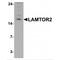 Late Endosomal/Lysosomal Adaptor, MAPK And MTOR Activator 2 antibody, MBS153393, MyBioSource, Western Blot image 