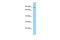 NAD Synthetase 1 antibody, A08229, Boster Biological Technology, Western Blot image 