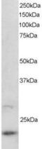 ADP Ribosylation Factor Like GTPase 2 antibody, PA5-18076, Invitrogen Antibodies, Western Blot image 