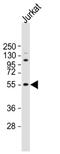 Neuropilin And Tolloid Like 2 antibody, MBS9211489, MyBioSource, Western Blot image 