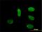 Mediator Complex Subunit 17 antibody, H00009440-M01, Novus Biologicals, Immunocytochemistry image 