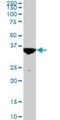 Mesenchyme Homeobox 2 antibody, H00004223-M03, Novus Biologicals, Western Blot image 