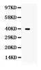 Tribbles Pseudokinase 2 antibody, PA5-80186, Invitrogen Antibodies, Western Blot image 