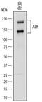 ALK Receptor Tyrosine Kinase antibody, AF4210, R&D Systems, Western Blot image 