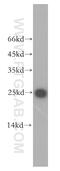 THO Complex 7 antibody, 17881-1-AP, Proteintech Group, Western Blot image 