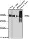 Inositol 1,4,5-Trisphosphate Receptor Type 1 antibody, A7905, ABclonal Technology, Western Blot image 