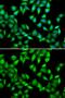 Myosin Light Chain 3 antibody, GTX33340, GeneTex, Immunofluorescence image 